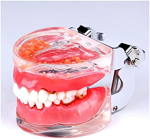 Modelo de Ensino de Estudo de Dentes Kh66zky Typodont - Modelo Dental de Doenças Periodontais - Modelo Dentro de Demonstração