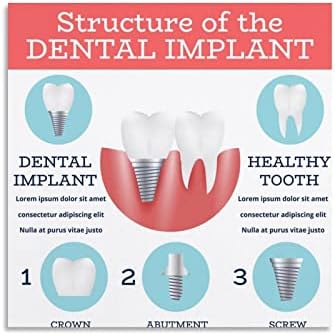 Bludug Dental Implant Dental Care Poster Dental Clinic Poster Poster Posters e Impressões de Arte da parede Fotos para Decoração do